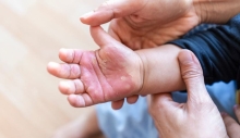 Bí quyết xử lý vết bỏng không để lại sẹo – Ước mơ của nhiều người về làn da mịn màng