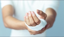 Cách xử lý vết thương không để lại sẹo - Mẹo hay bạn cần biết