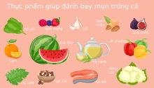 Những Thực Phẩm Không Tốt Cho Da Mụn