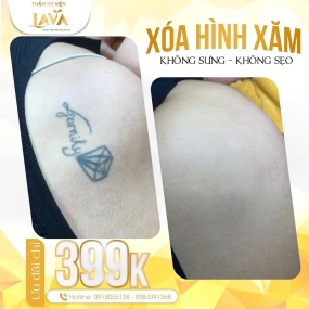 THẨM MỸ VIỆN QUỐC TẾ LAVA