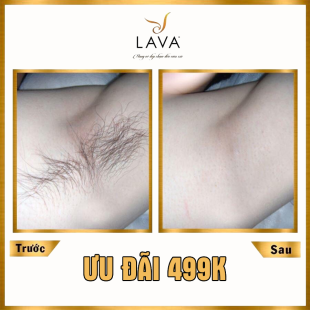 THẨM MỸ VIỆN QUỐC TẾ LAVA