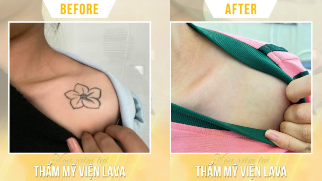 THẨM MỸ VIỆN QUỐC TẾ LAVA