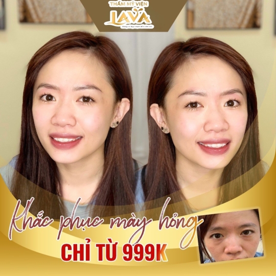 KHẮC PHỤC MÀY HỎNG CHỈ TỪ 999K