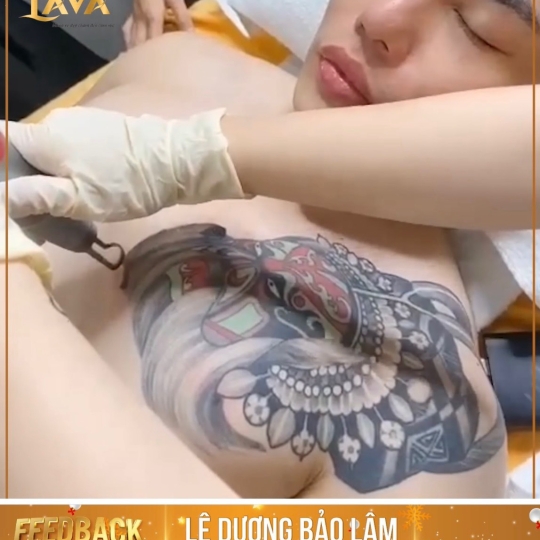 XOÁ XĂM KHÔNG SẸO TẠI TPHCM - GIÁ CHỈ TỪ 199K